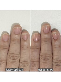 自爪育成ネイルケア