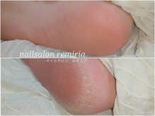 ネイルサロン レミリア(Remiria)の雰囲気（角質ケアと足裏パックでガサガサ踵もツルツルモチモチに☆）