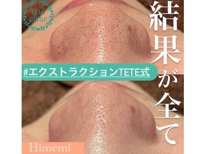 ヒメミ(Himemi)の写真
