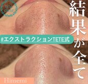 ヒメミ(Himemi)