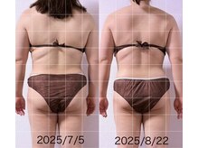 サロン アモル(salon amor)/インディバで背中スッキリ！