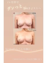 スカイ(sky)/美バスト＆美姿勢