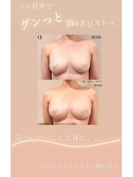 スカイ(sky)/美バスト＆美姿勢