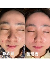 ラメール(La mer)/vosサロンケアの実力！