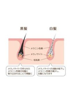 メンズ脱毛ダイアナ 松江店/どうして白髪になるの?