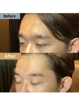 眉毛ハウス 吉祥寺店(眉毛HOUSE)/お客様の施術例(吉祥寺/東京)