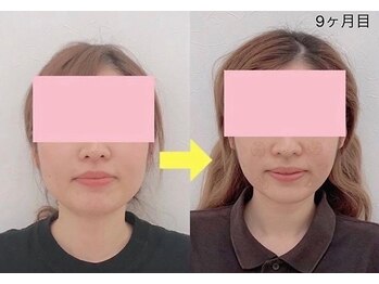 金沢西えみふる整骨院 整体院/小顔/骨盤矯正