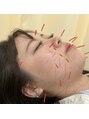 四條畷わだち整骨院 美容鍼は、自律神経を整えるので、美容と健康を同時にケア可能◎