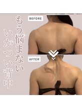 ソワン(Soin)/ブライダル背中二の腕