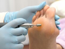 巻き爪専門ラボ 名古屋栄店/タコ魚の目撃退！