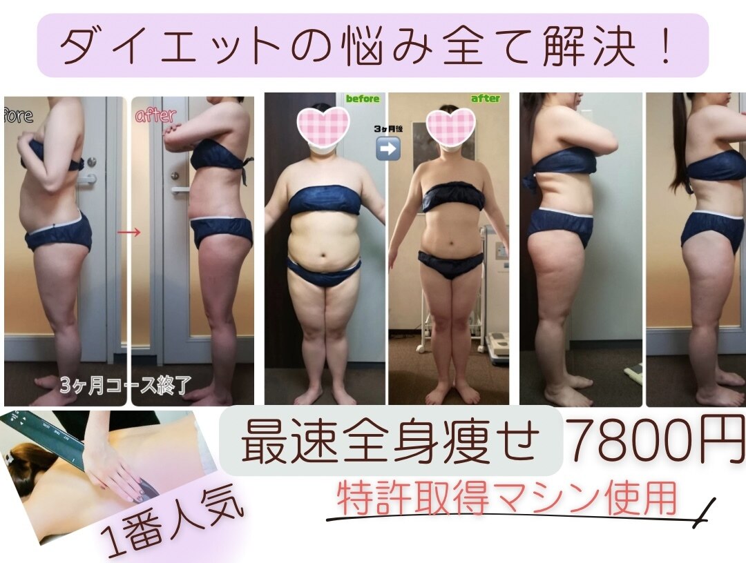 ダイエット サポート(DIET SUPPORT)｜ホットペッパービューティー