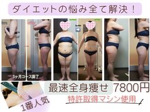 ダイエット サポート(DIET SUPPORT)