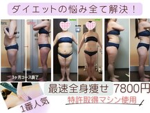 ダイエット サポート(DIET SUPPORT)