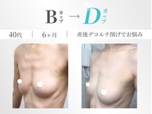 美人バスト 錦糸町店の雰囲気(気持ち良い施術で戻らない育乳メゾット☆バストアップ)