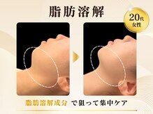 ルティナ(LUTINA)の雰囲気（【小顔人気】脂肪分解で二重あご・フェイスラインを集中ケア）