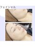 本気の小顔☆肩首からグンとフェイスラインリフトUP☆リンパ×ラジオ波9800→