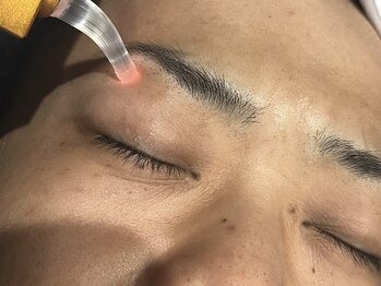 アシュラ(ASHURA)/細部までこだわった脱毛♪