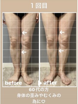 メゾン ド クロエ(Maison de Chloe)/CHLOE式パーソナル痩身