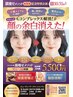 シャンティ式顔小顔メソッド★【小顔矯正＋溶解マシン】　2回　5,500円