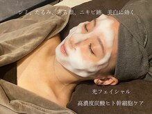ビモアス(bimous)