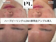 プルスキンサロン 大阪店(pull skin salon)/