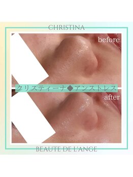 ボーテ ドゥ ランジュ(BEAUTE DE L’ANGE.)/◆アンストレス◆