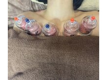 リベル(Liber)/デコルテカッピングで邪気を出す