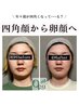 【エラ張り・余白】小顔矯正＋高濃度酸素オイルリンパケア￥11,000→￥8,900