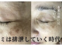 30代からの美肌ケア◎結果重視の感動体験/フェイシャル/シミケア