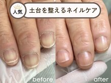 不要な角質を取り除くと、爪はどんどん伸びていく♪