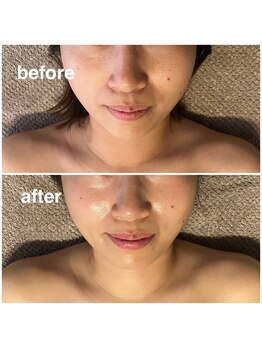 ナイスデイ(Niceday!)/5歳若見え プルプル肌