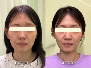 整音(totonone)の写真/その場しのぎではなく定着へ。最短1ヶ月で理想の小顔に。