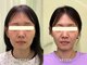 整音(totonone)の写真/その場しのぎではなく定着へ。最短1ヶ月で理想の小顔に。