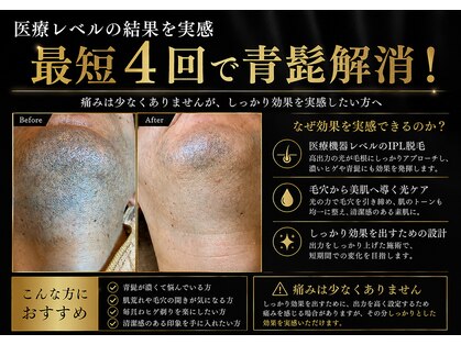 アルト(ALTO)の写真
