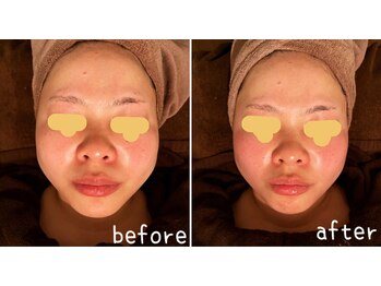 エルア(2 elua)/造顔筋リンパドレナージュ