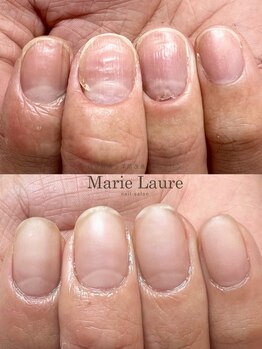マリーロール 淀屋橋本店(Marie Laure)/自爪育成/深爪矯正/ネイルケア