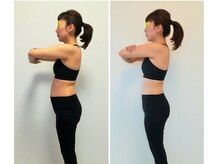 かんだ接骨院/37歳　骨盤ダイエット横面