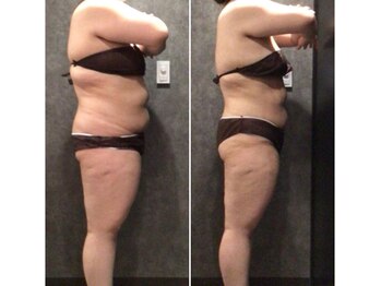 フローボディ 新山口店(flow BODY)/山口のエステはflow BODY