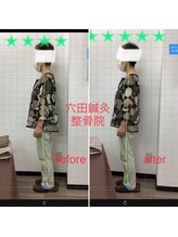 穴田鍼灸整骨院/整体・骨盤・ねこぜ・まき肩矯正