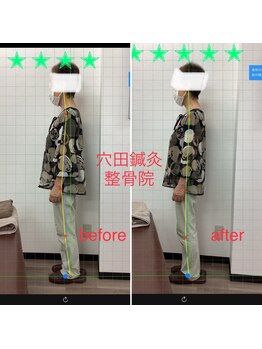 穴田鍼灸整骨院/整体・骨盤・ねこぜ・まき肩矯正