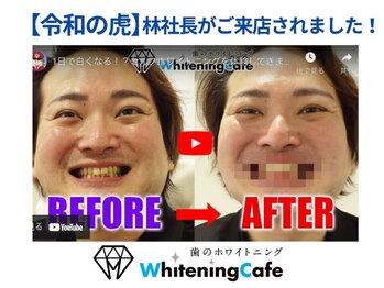 ホワイトニングカフェ 立川店(WhiteningCafe)/◎ホワイトニングカフェ立川店