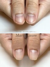 マリーロール 淀屋橋本店(Marie Laure)/自爪育成/深爪矯正/ネイルケア