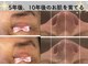 美温(mion)の写真