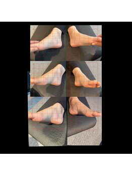 ハーモニーフィットネス 赤坂(Harmony Fitness)/扁平足改善