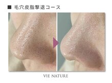 ヴィナチュール(vie nature)/ ■毛穴ケア