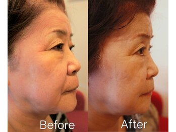 リラクゼーションステイ サクラ(SAKURA)/