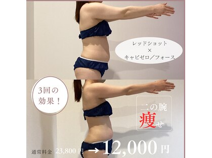 ビューティーサロン セガール(segar)の写真