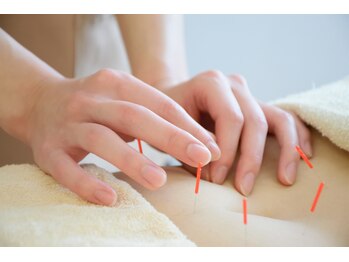 アンドコンディショニングルーム(&conditioning room)/【鍼灸】初心者の方にも安心♪