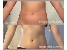 カシェット(cachette)/ウルトランスフォーマー