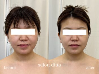 サロンディト(ditto)/【施術5回】小顔コルギ+肩甲骨
